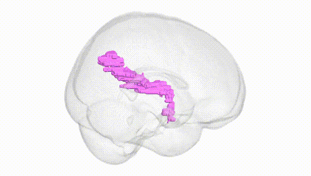 Full Brain White
