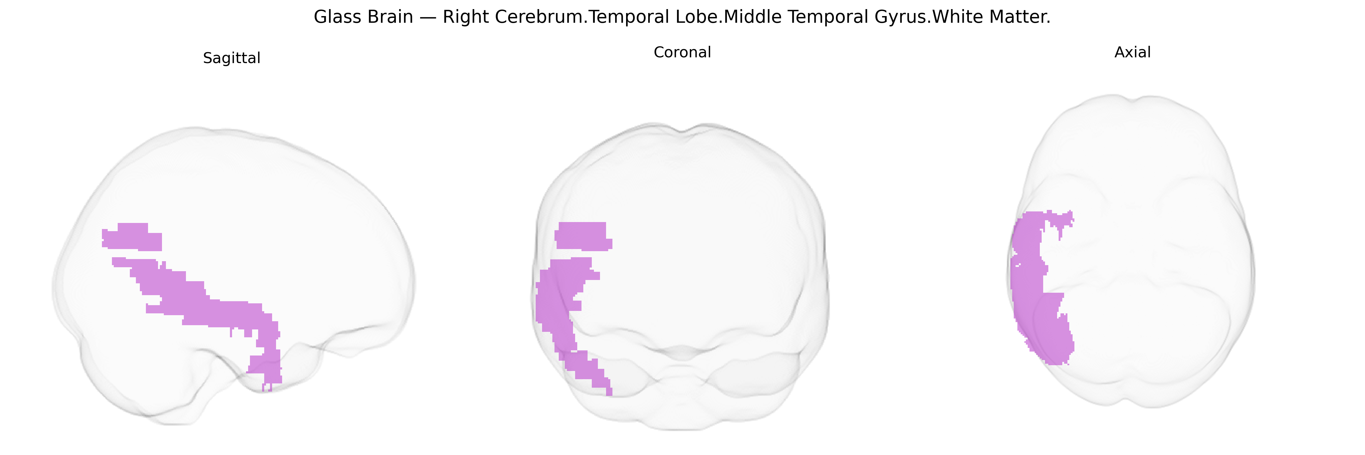 Triplanar Ghost Brain