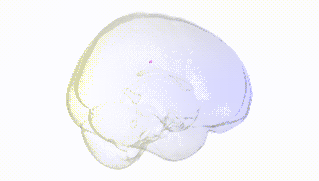 Full Brain White