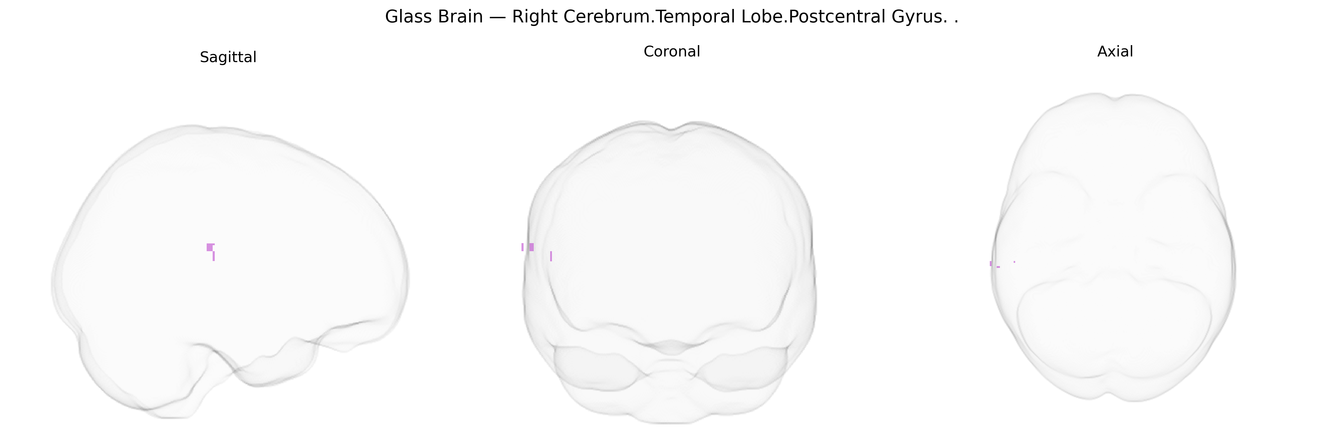 Triplanar Ghost Brain