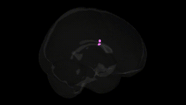 Full Brain Black