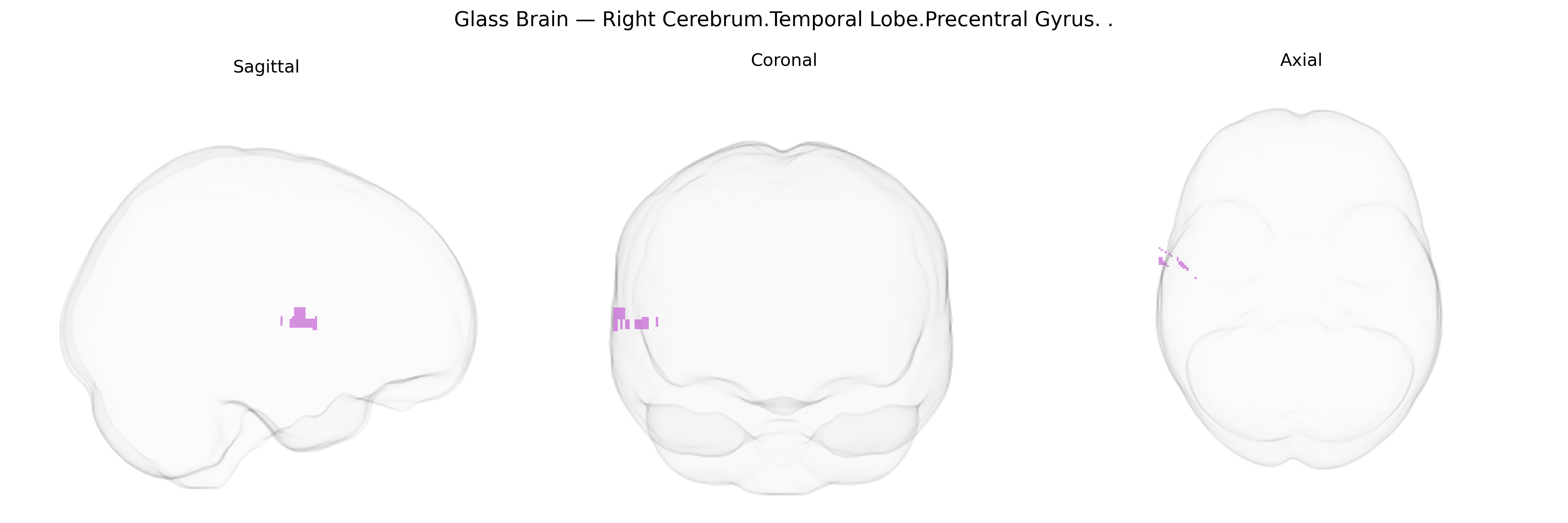 Triplanar Ghost Brain