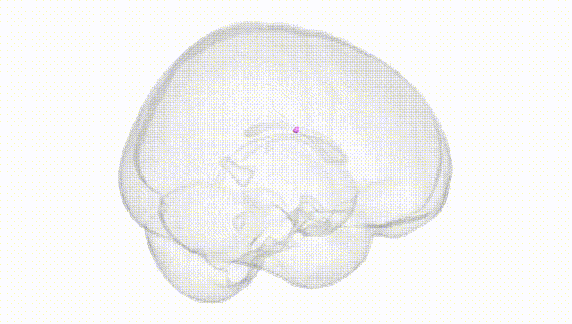 Full Brain White