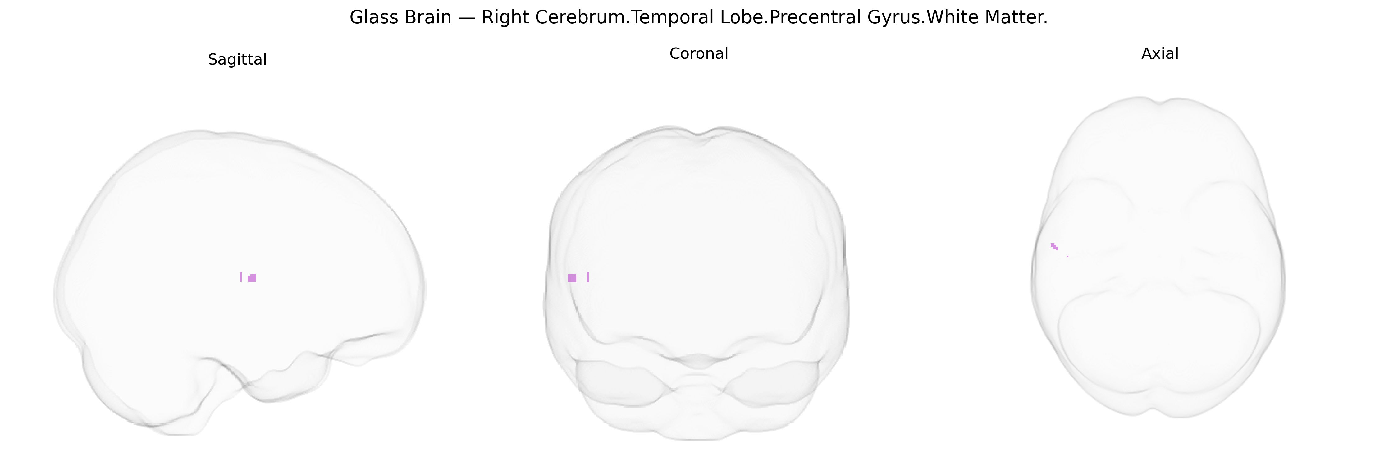 Triplanar Ghost Brain