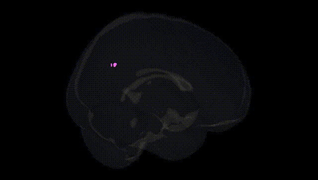 Full Brain Black