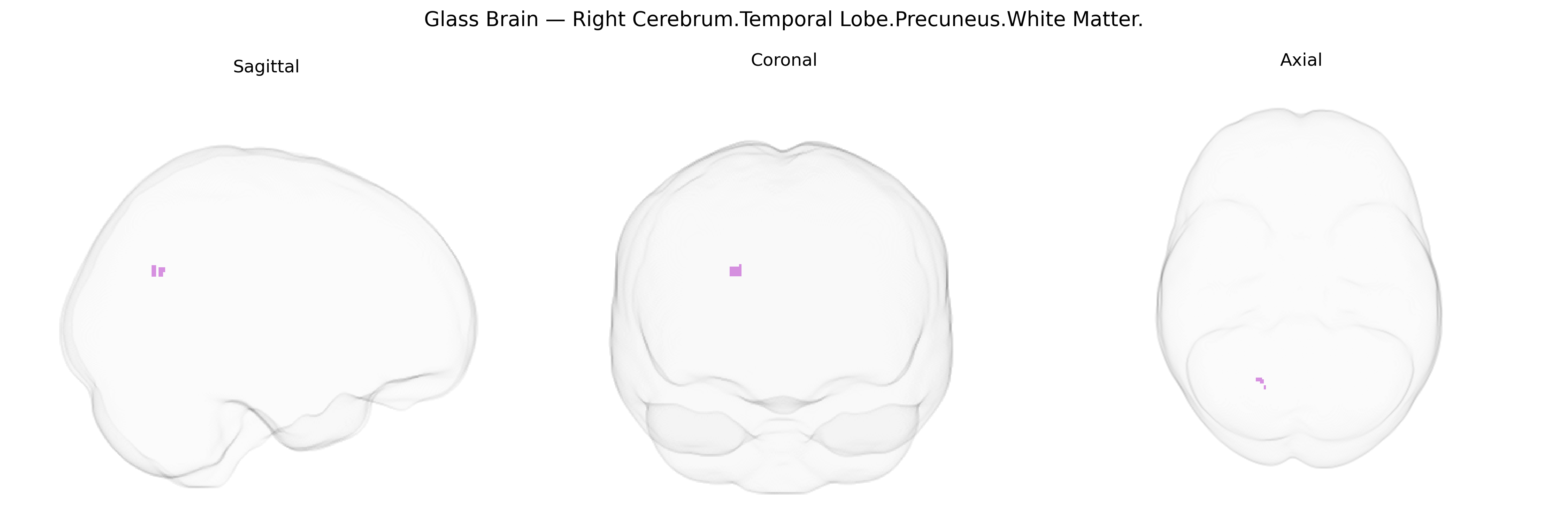 Triplanar Ghost Brain
