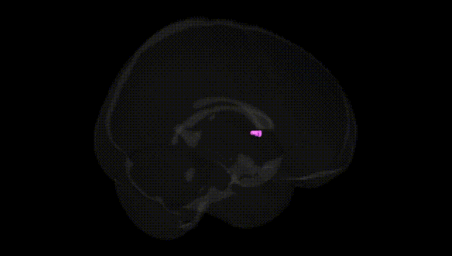 Full Brain Black
