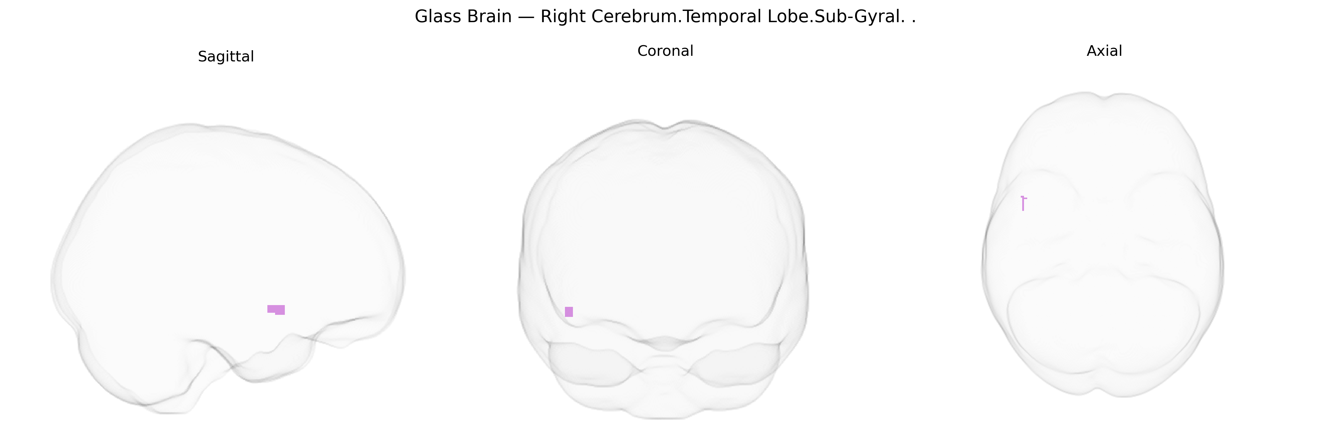 Triplanar Ghost Brain