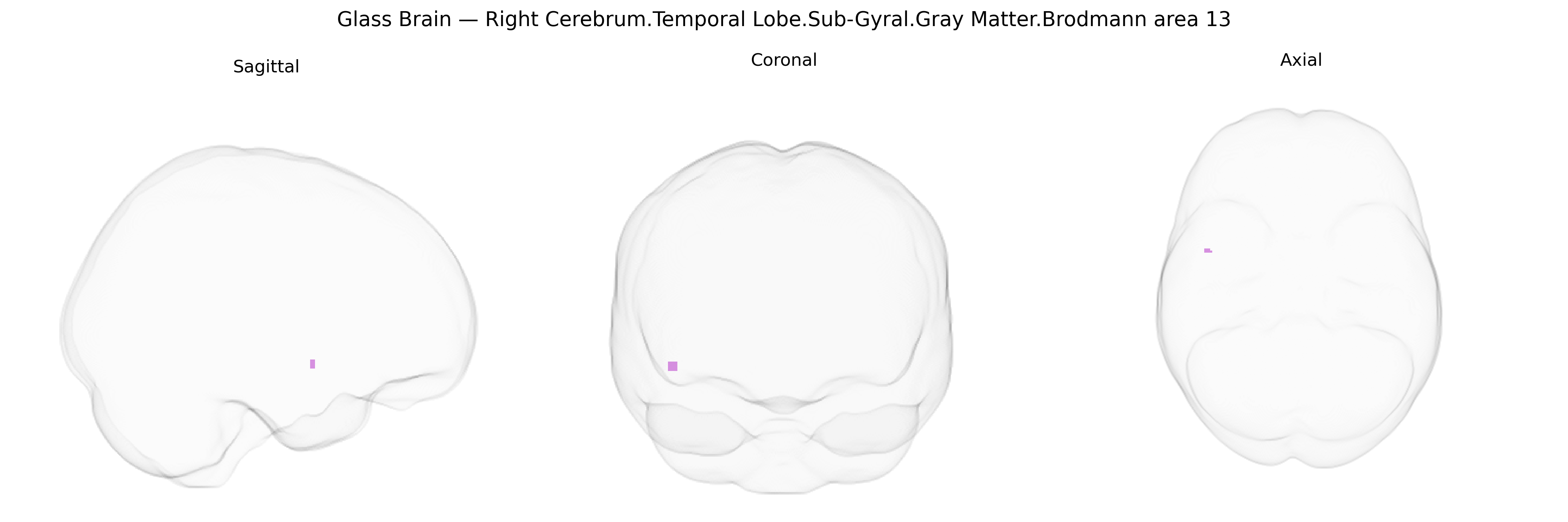 Triplanar Ghost Brain
