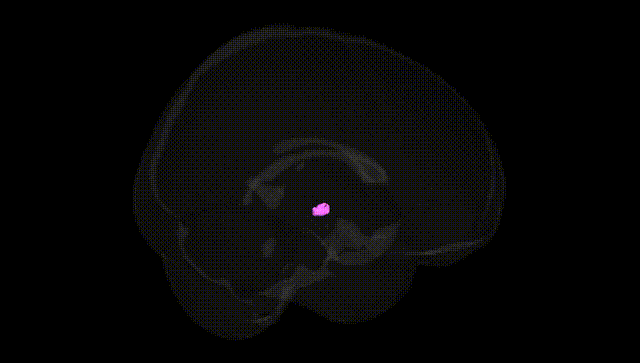 Full Brain Black