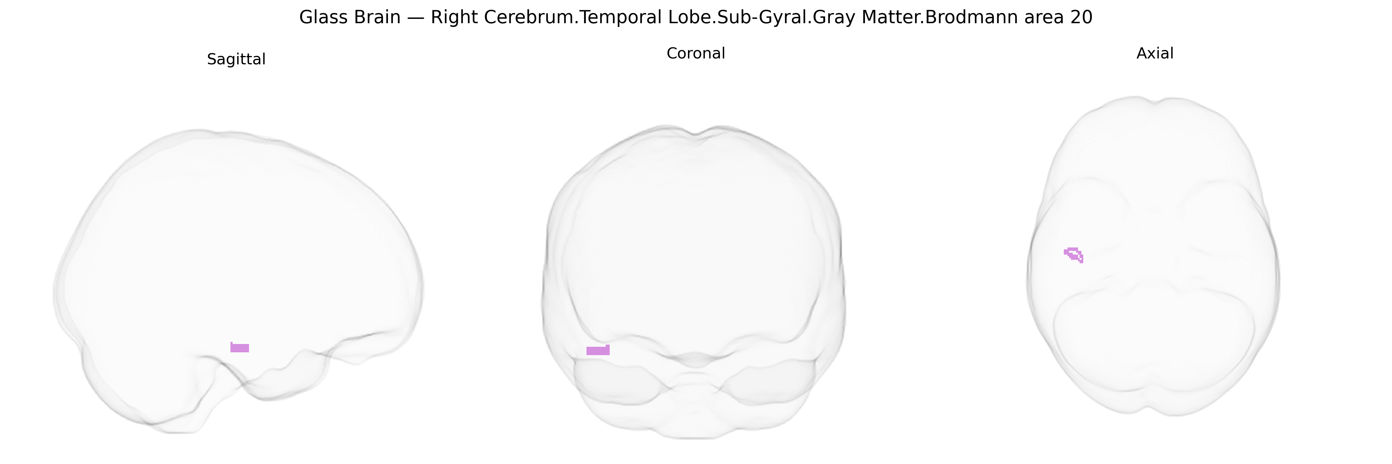 Triplanar Ghost Brain