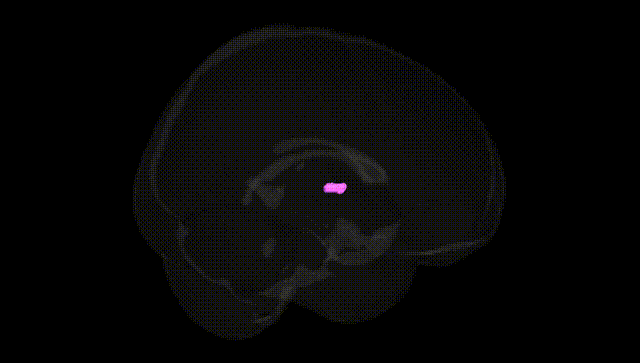 Full Brain Black
