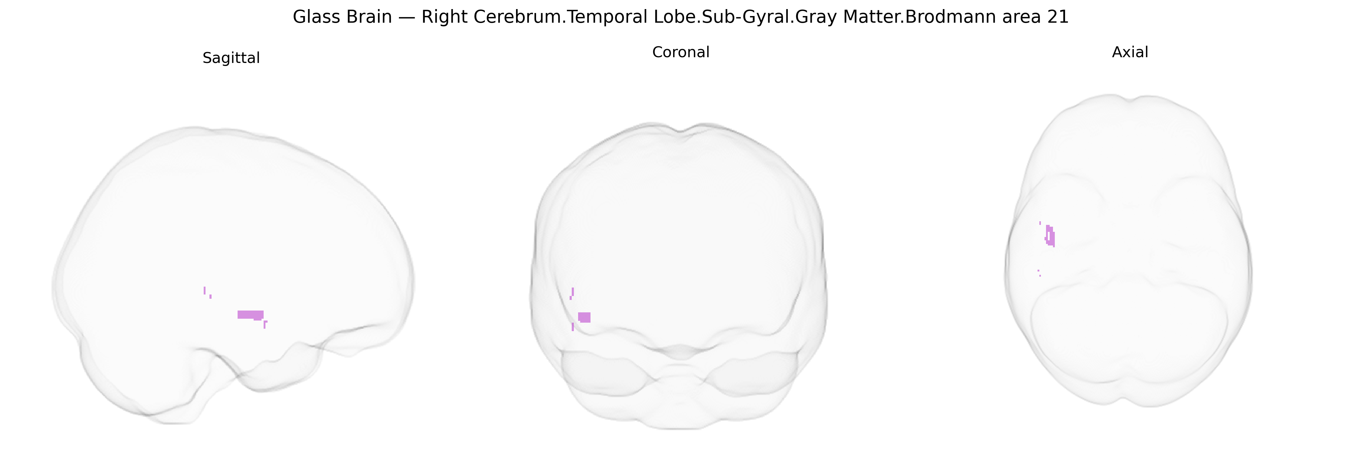 Triplanar Ghost Brain