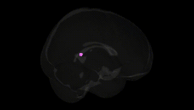 Full Brain Black