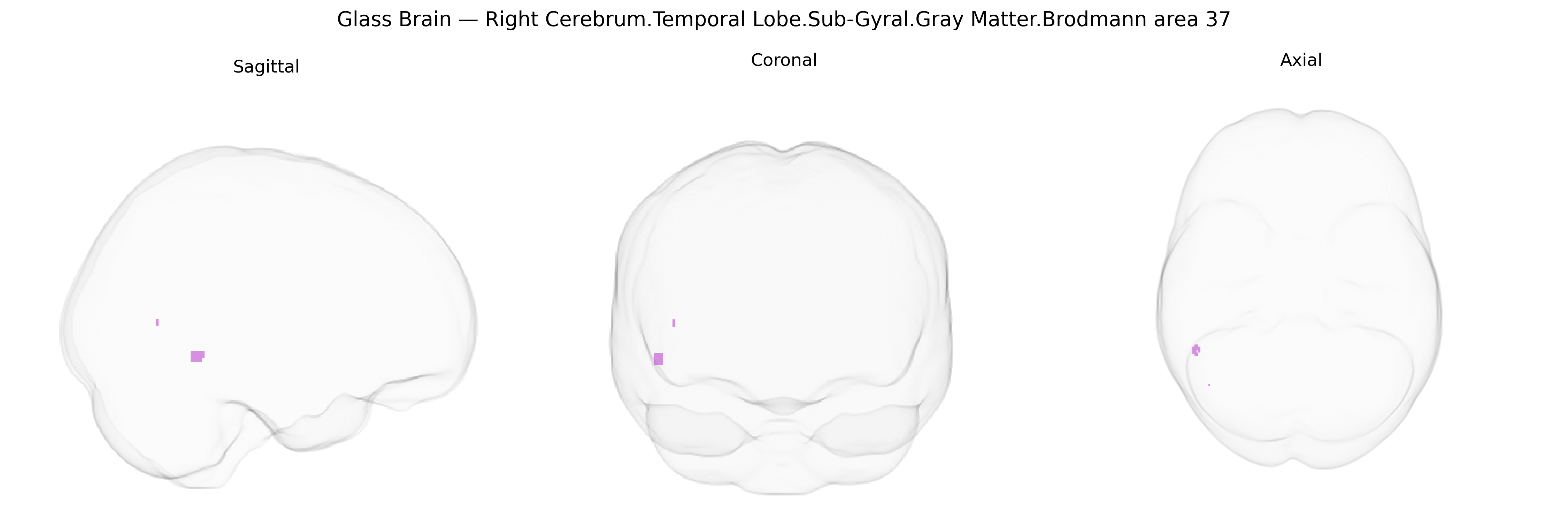 Triplanar Ghost Brain