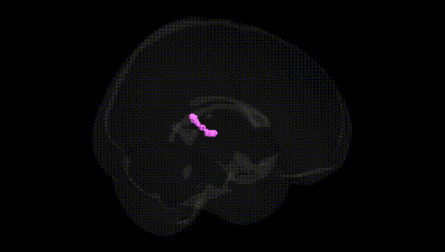 Full Brain Black
