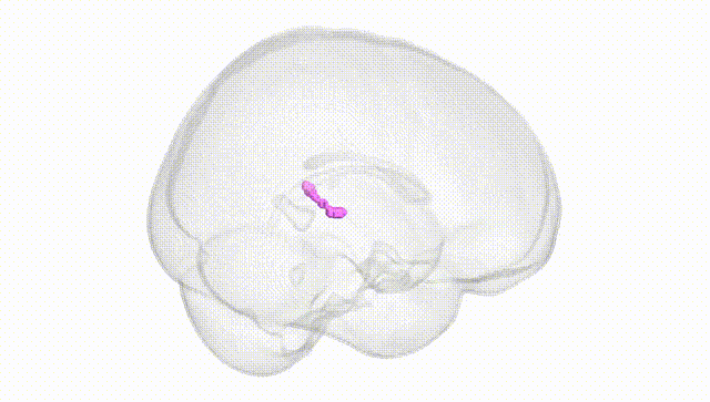 Full Brain White