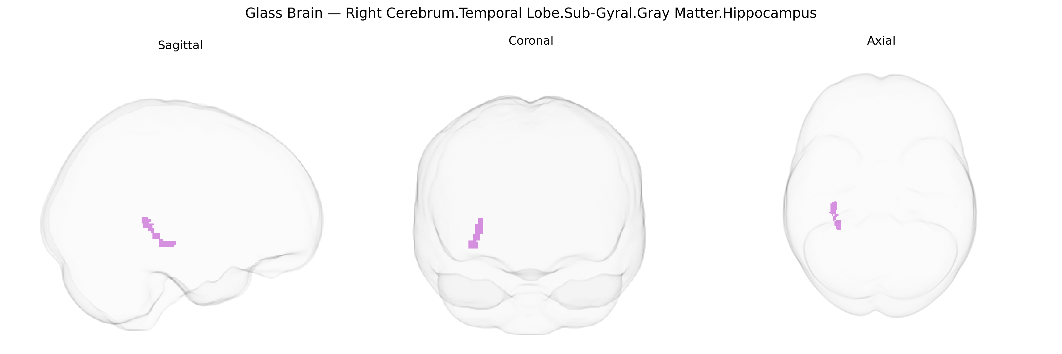 Triplanar Ghost Brain