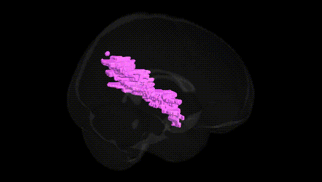Full Brain Black
