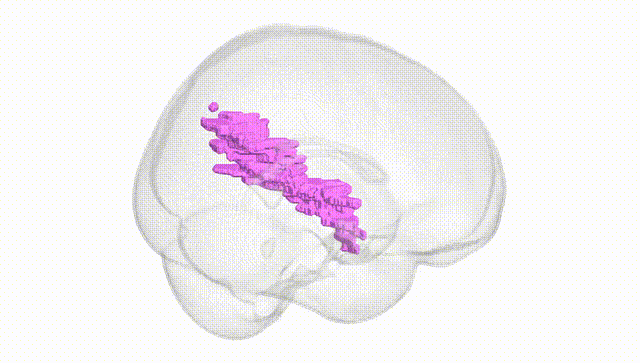 Full Brain White