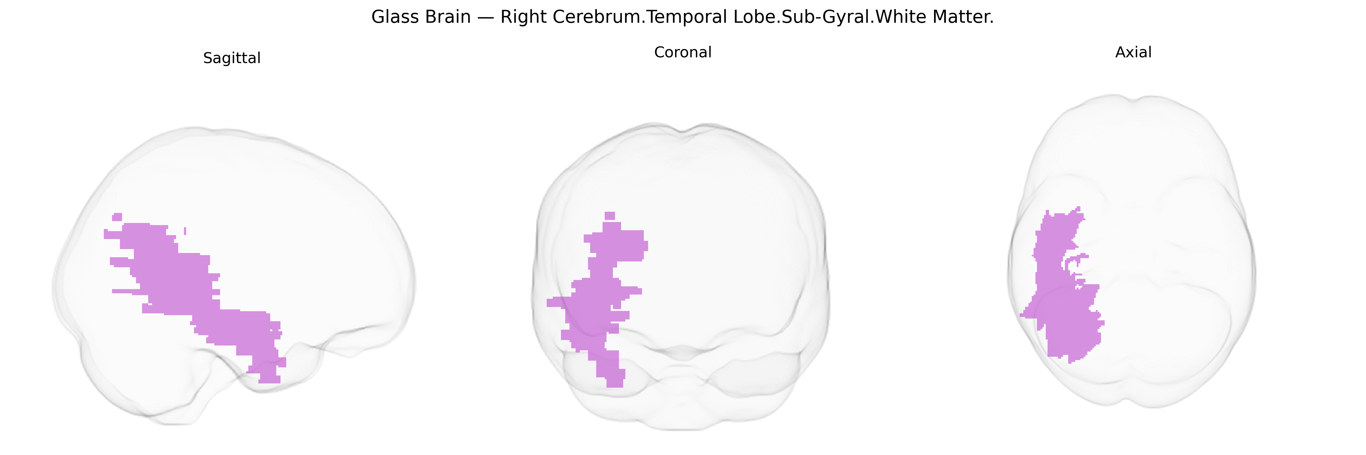 Triplanar Ghost Brain