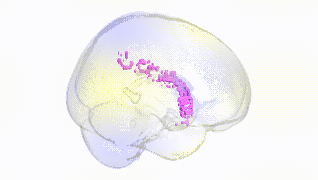 Full Brain White