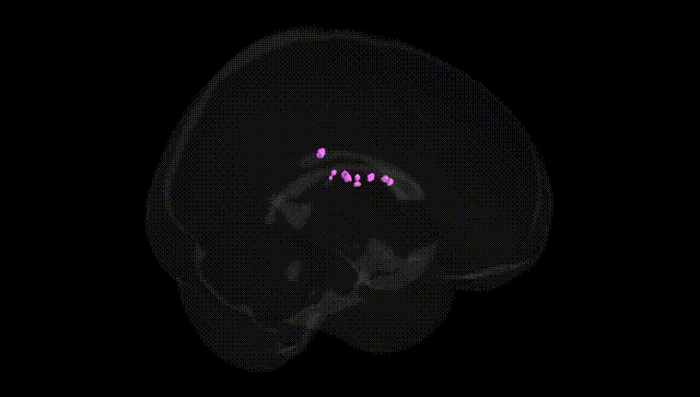 Full Brain Black