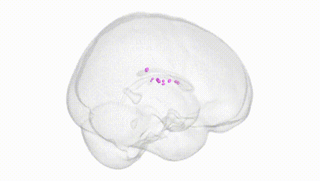 Full Brain White