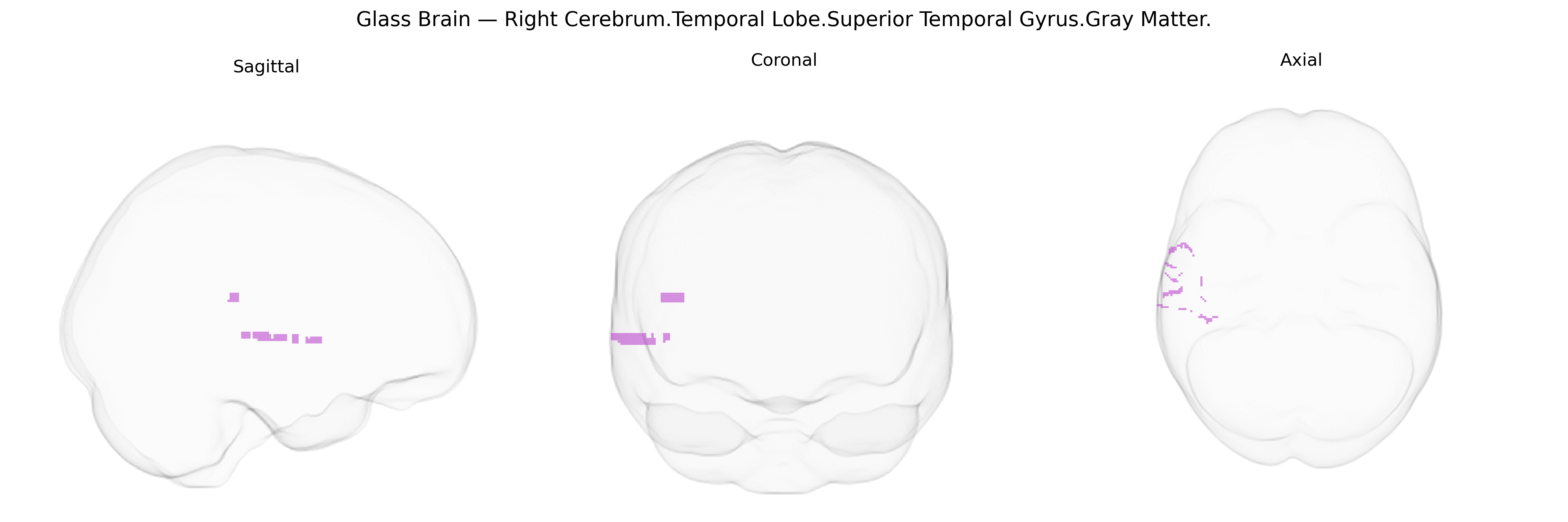 Triplanar Ghost Brain