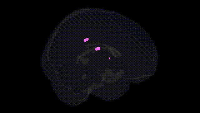 Full Brain Black