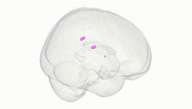 Full Brain White