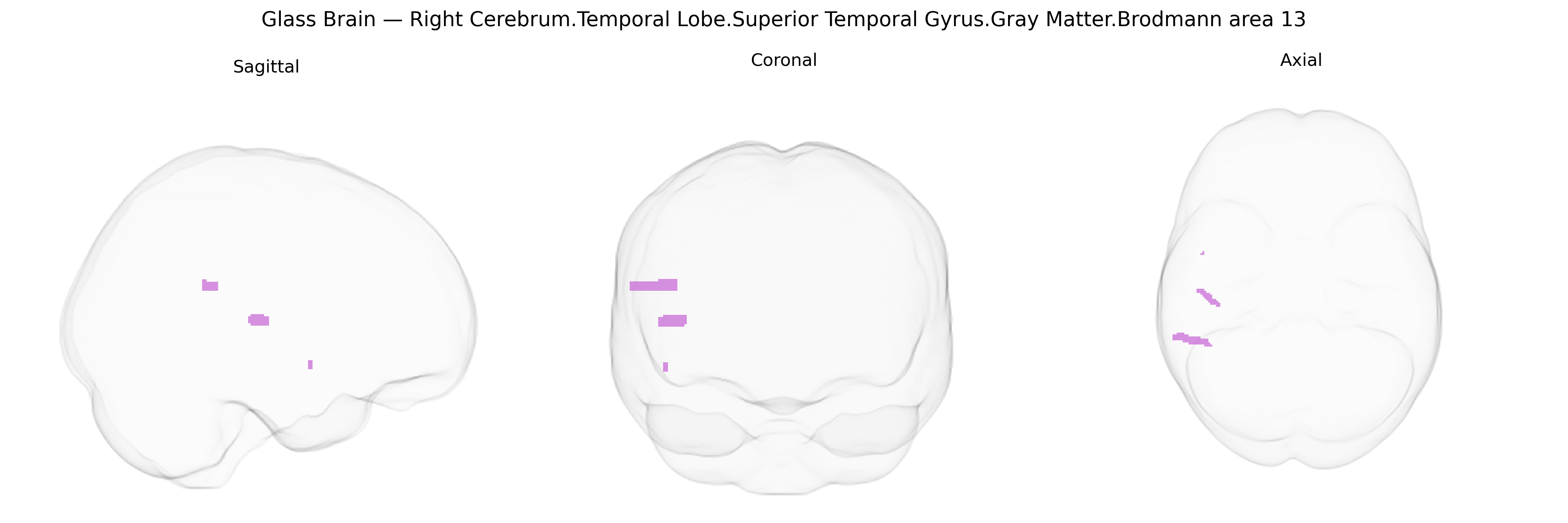 Triplanar Ghost Brain