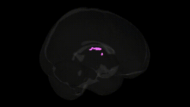 Full Brain Black