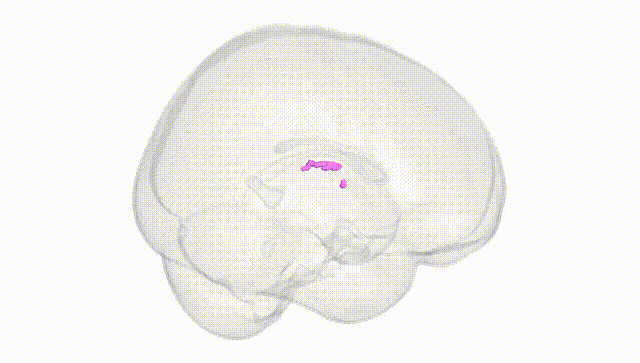 Full Brain White