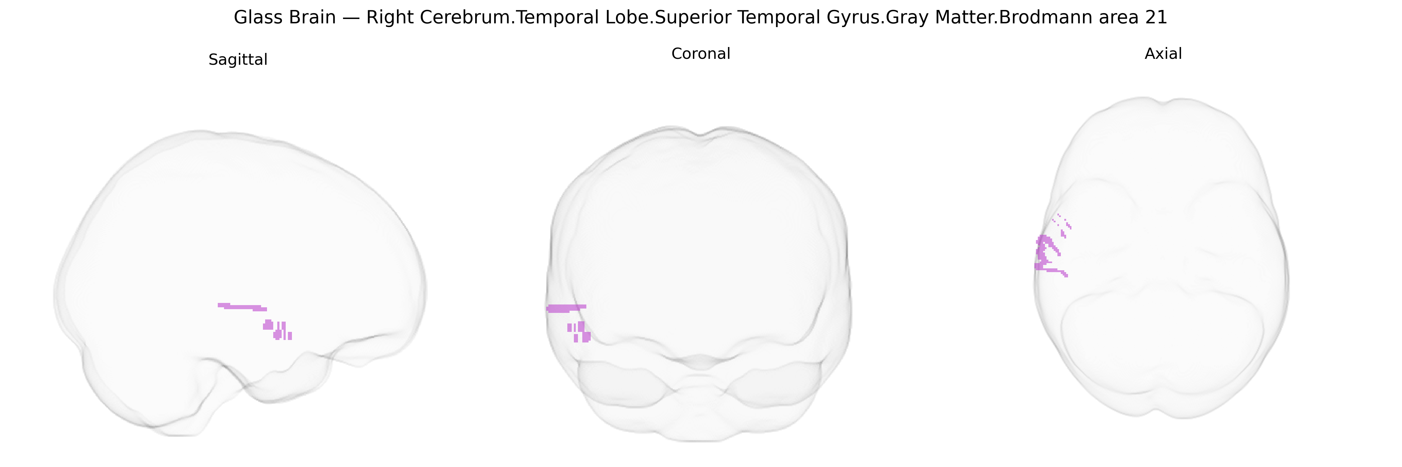 Triplanar Ghost Brain