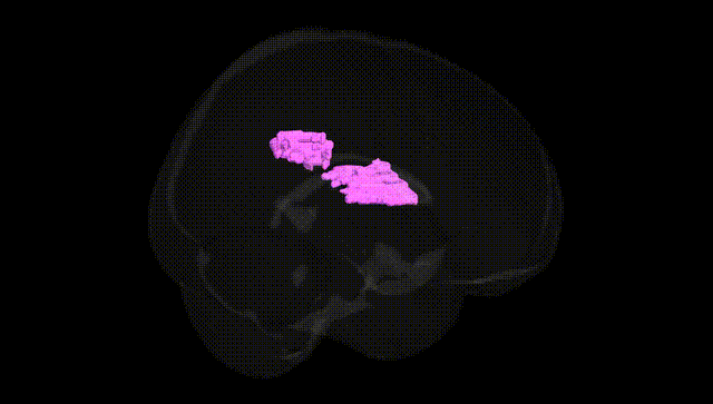 Full Brain Black