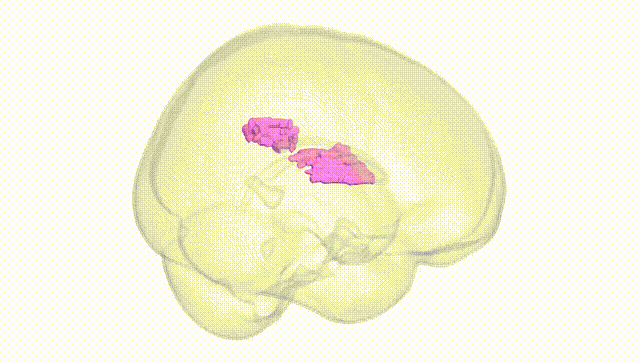 Full Brain White
