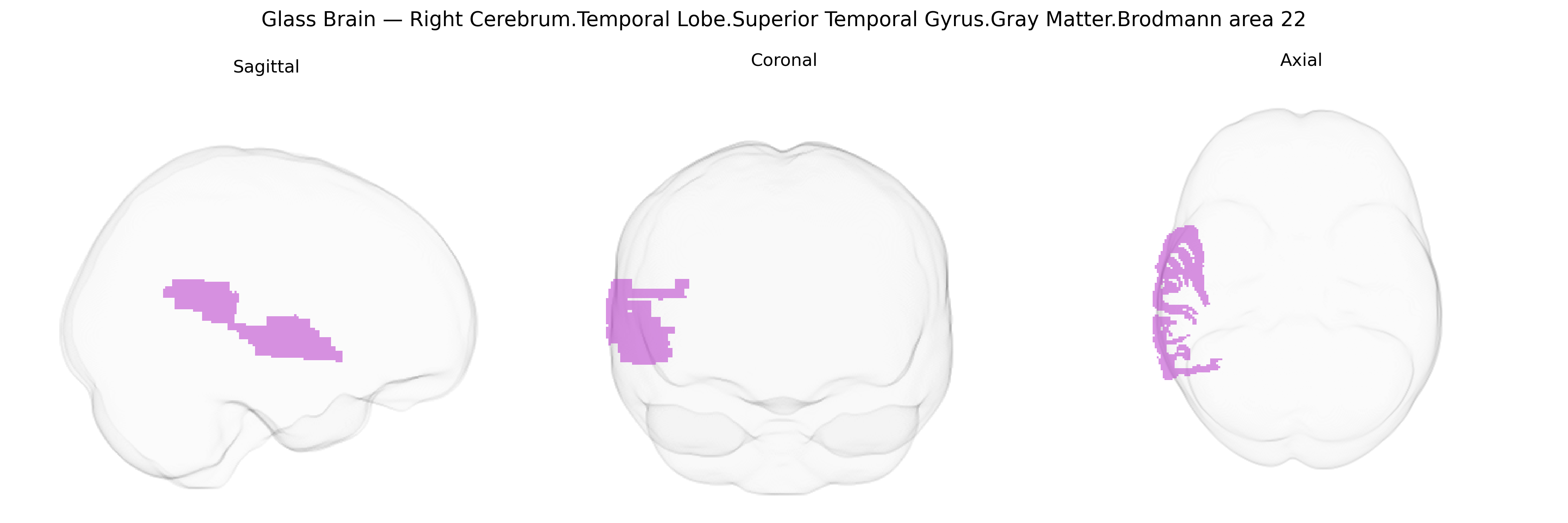 Triplanar Ghost Brain