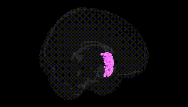 Full Brain Black