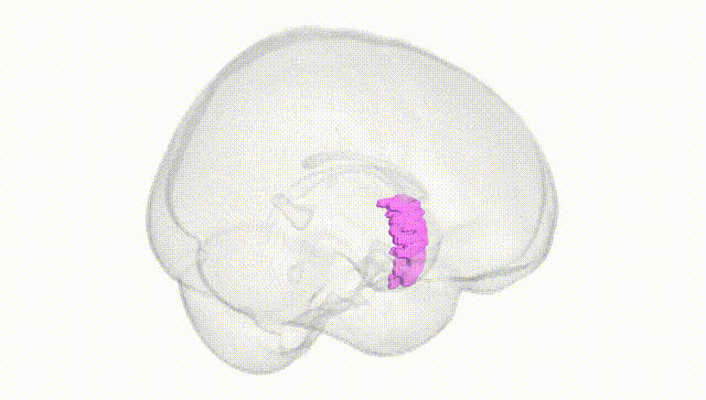Full Brain White