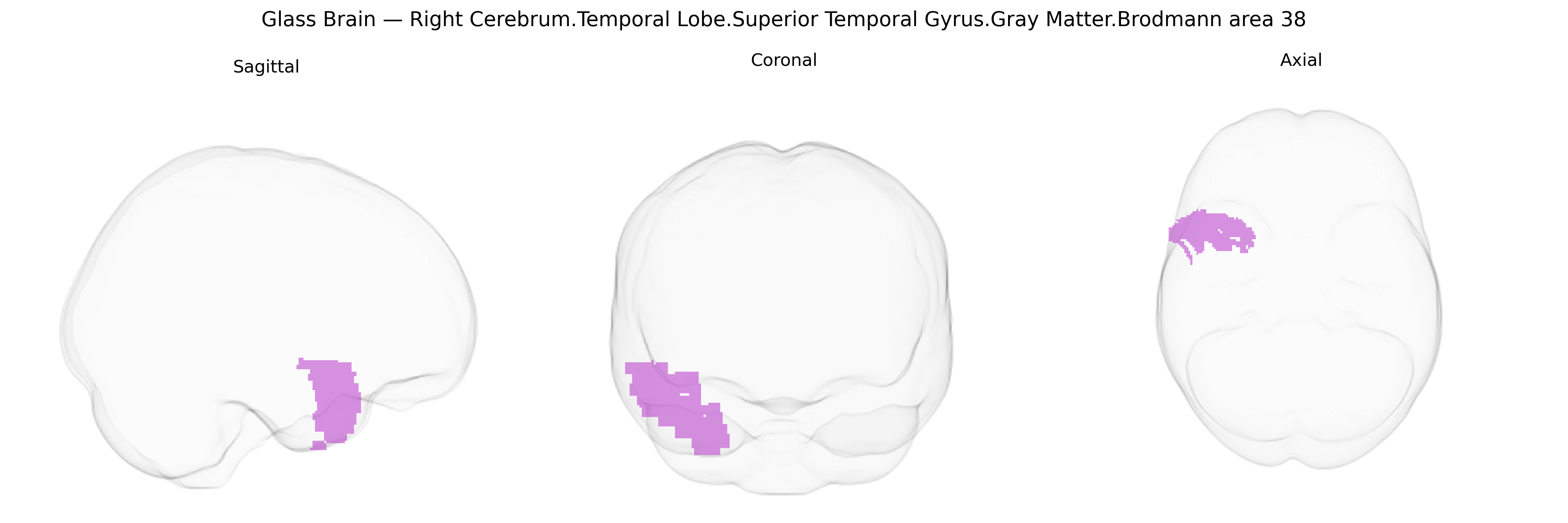 Triplanar Ghost Brain