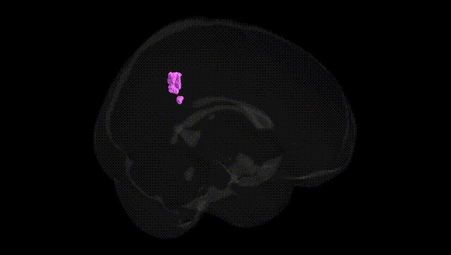 Full Brain Black