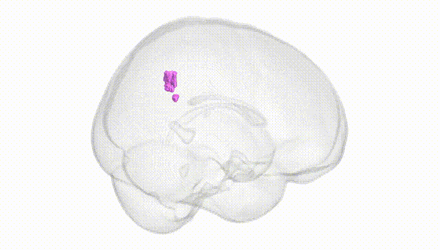 Full Brain White