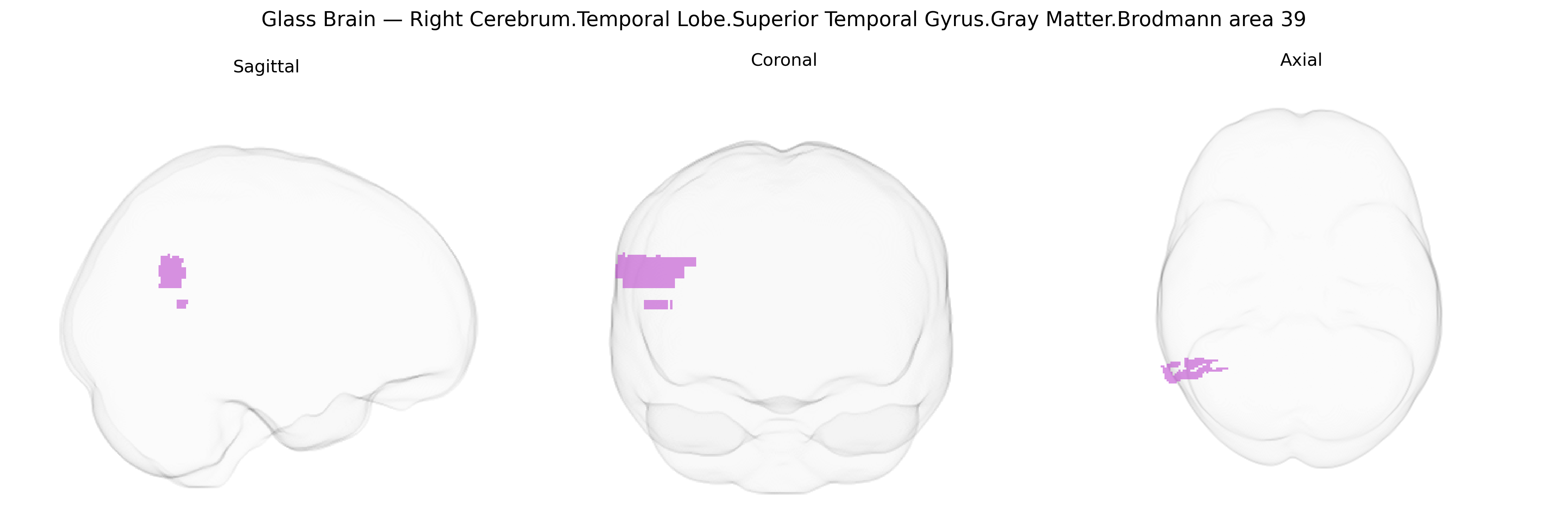Triplanar Ghost Brain