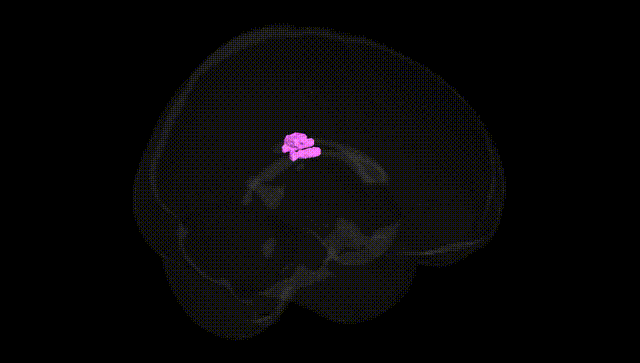 Full Brain Black