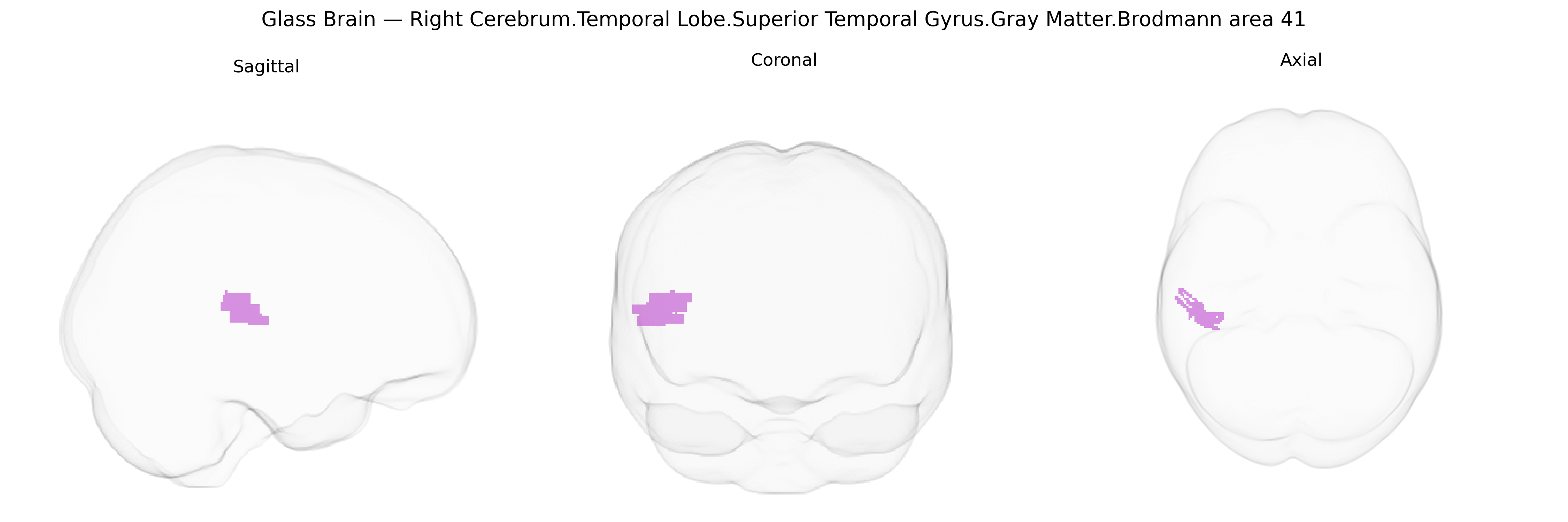 Triplanar Ghost Brain