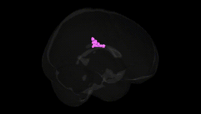 Full Brain Black