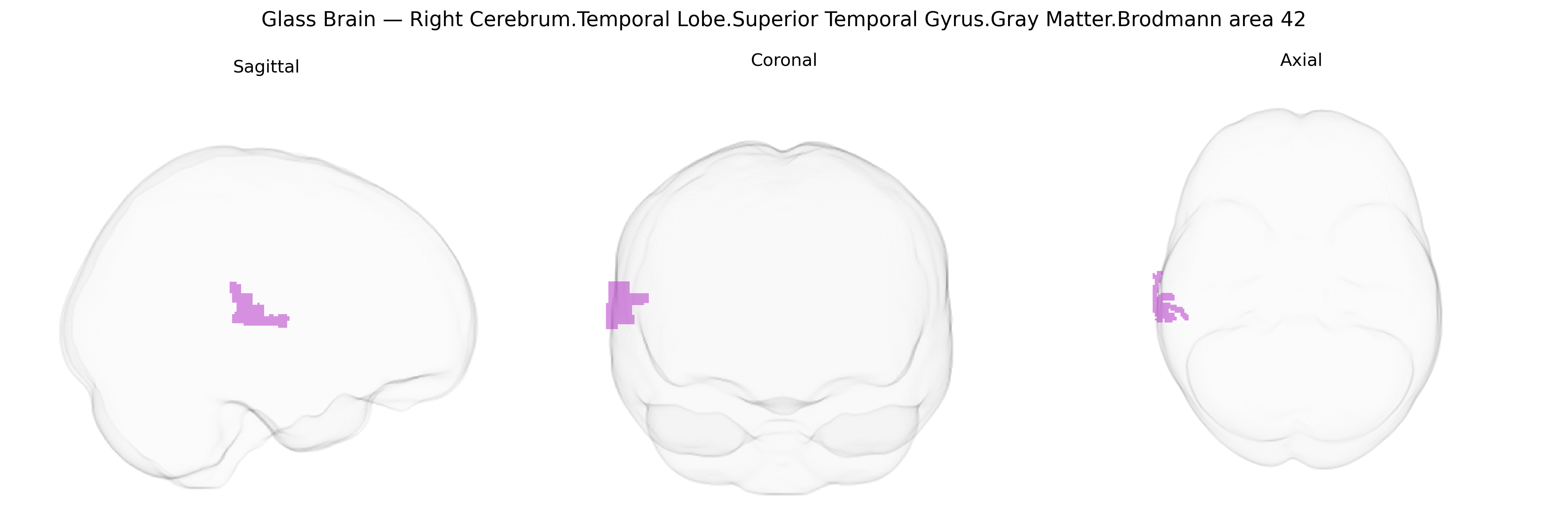 Triplanar Ghost Brain