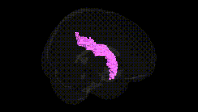 Full Brain Black