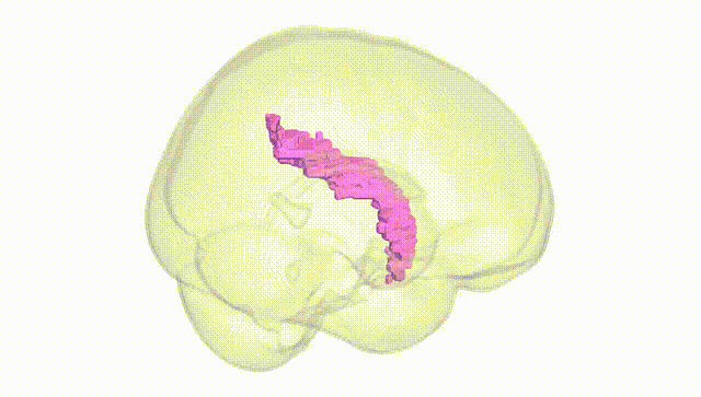 Full Brain White